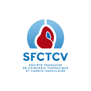 SFCTCV